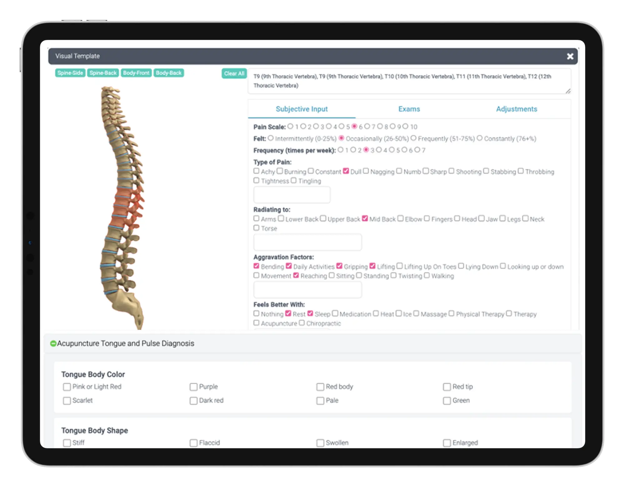 Image of human spine for acupuncture, chiropractic and PT physical therapy charting