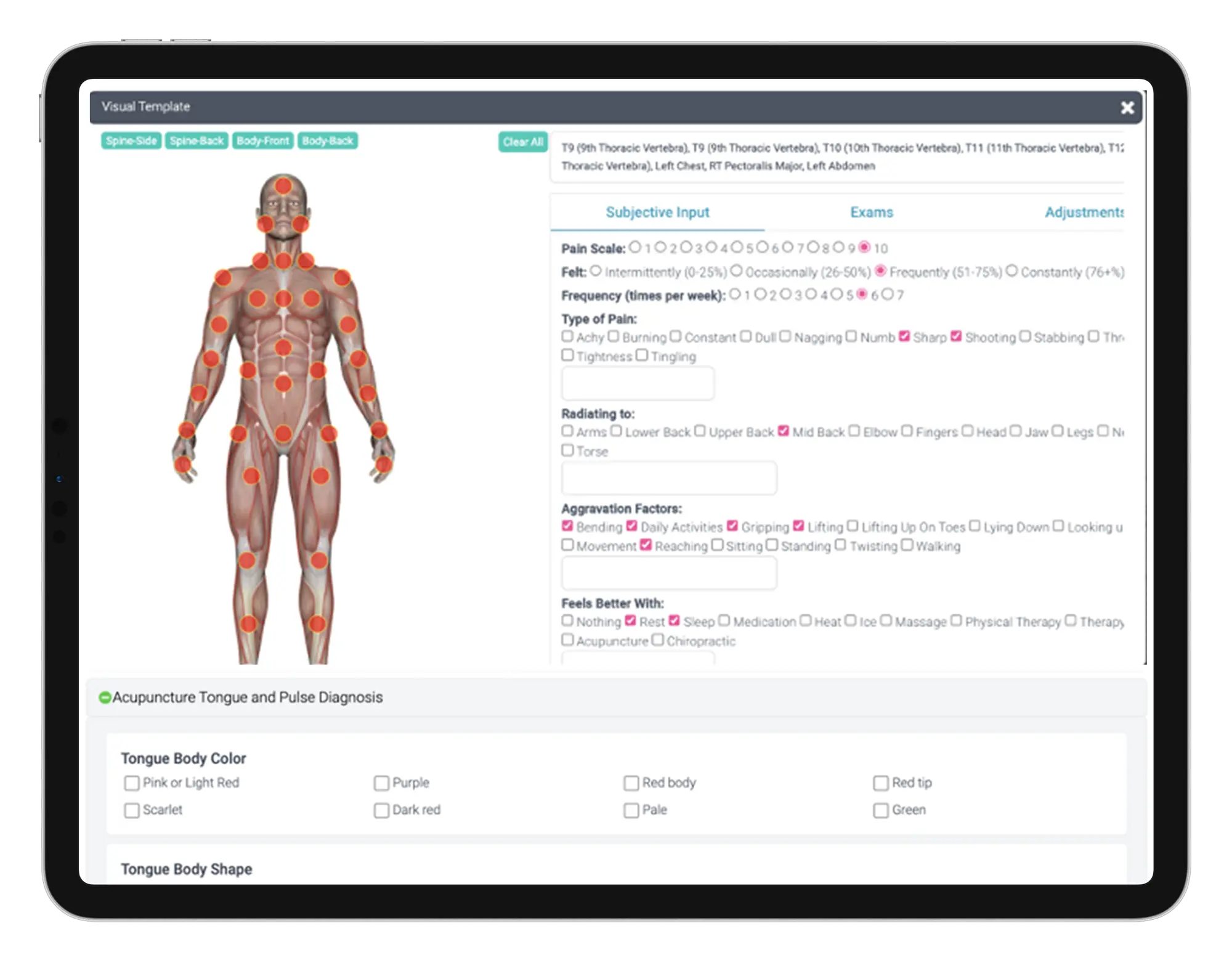 Image of human body for acupuncture, chiropractic and PT physical therapy charting